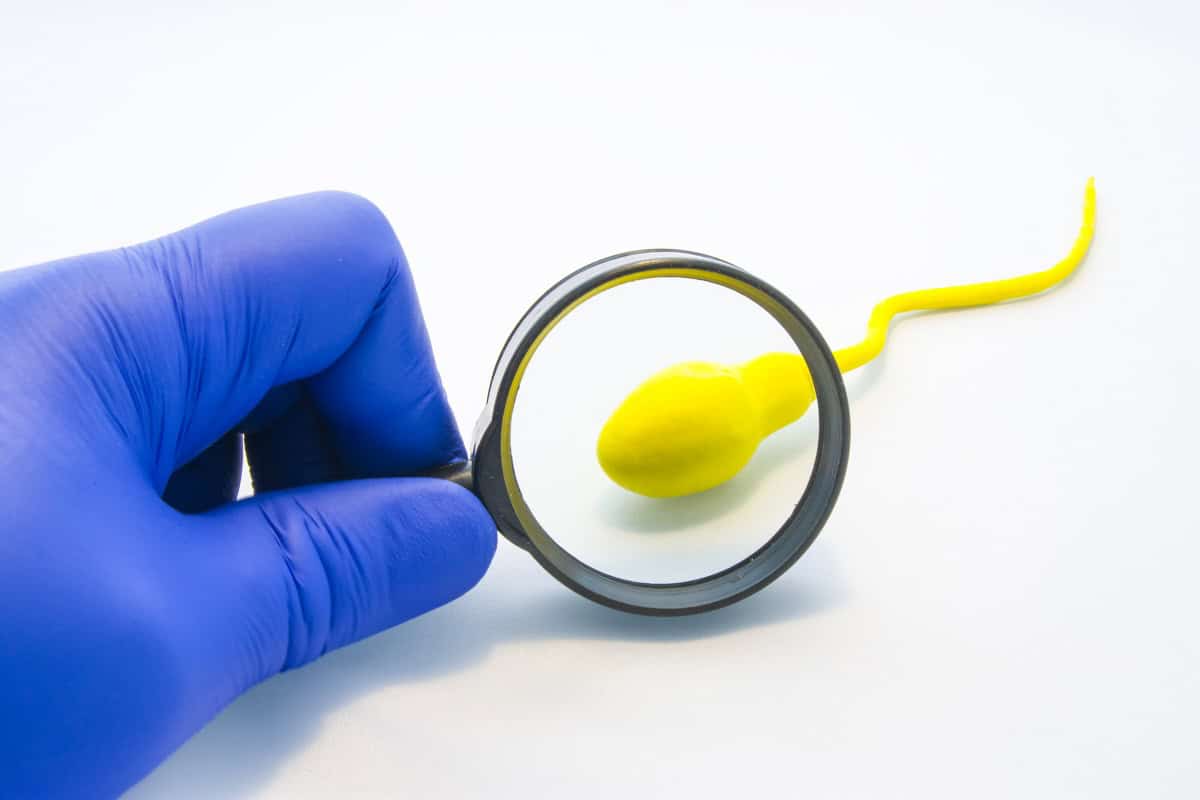 teratozoospermia-cause